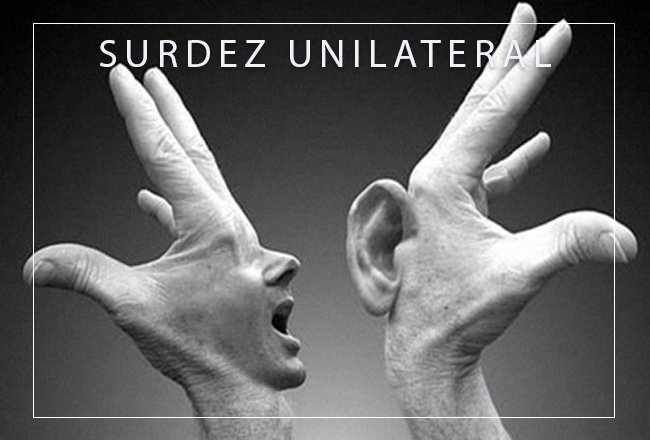 surdez unilateral