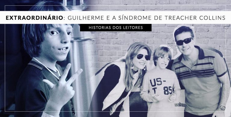 síndrome de treacher collins