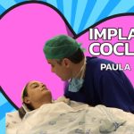 implante coclear bilateral
