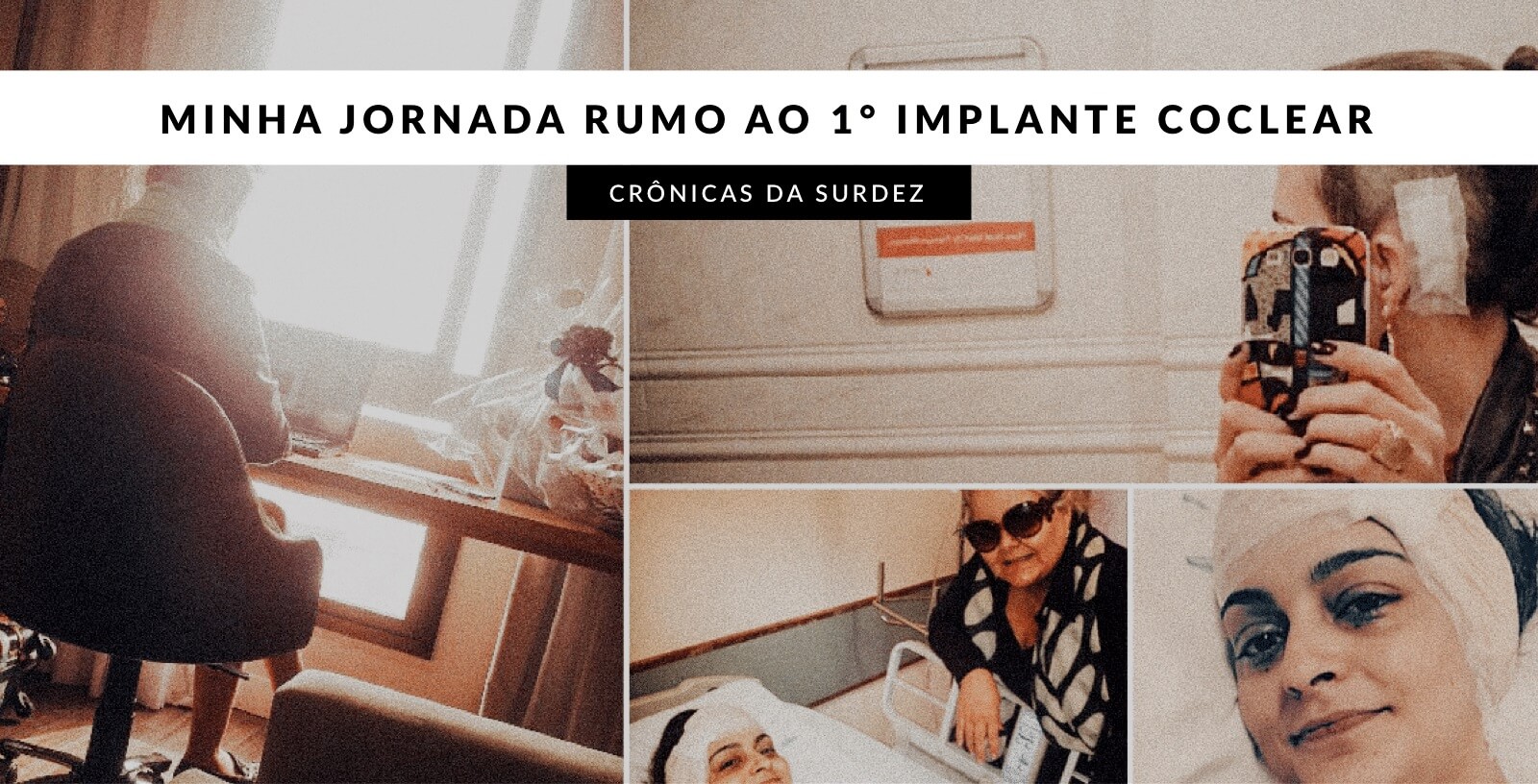 Implante coclear: jornada completa de Paula Pfeifer, da cirurgia à ativação