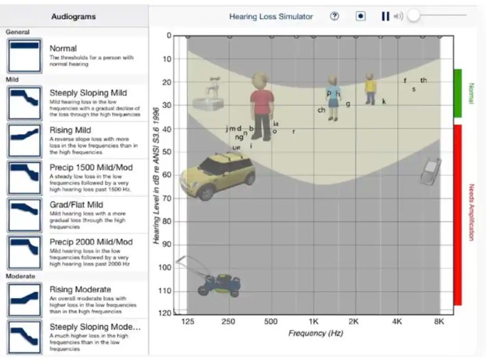 simulador de graus de surdez perda auditiva