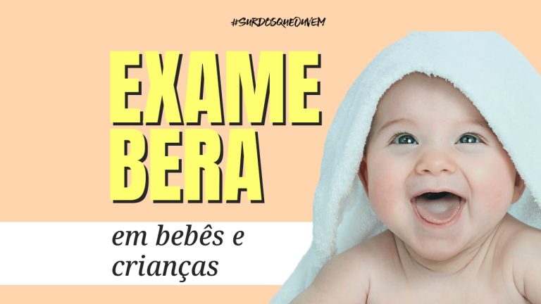 exame bera COM SEDAÇÃO ou sem sedação